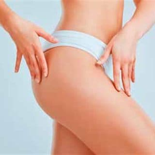 Relleno de glúteos con Sculptra