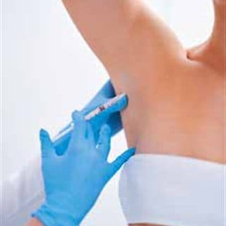 Toxina botulínica para hiperhidrosis
