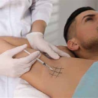 Toxina botulínica para hiperhidrosis